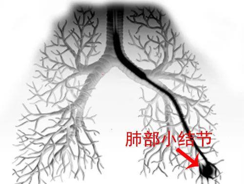 天眼在眉心的位置图 bb2917ad7905a991f208c8c50aa0cc0f67e778ed_52d93b799ed640b47b9a7874c6390cbf63acb577.jpeg@!w_400x268
